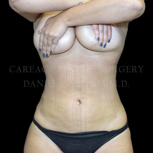 After Image