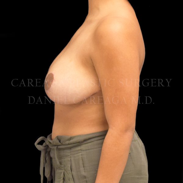 After Image