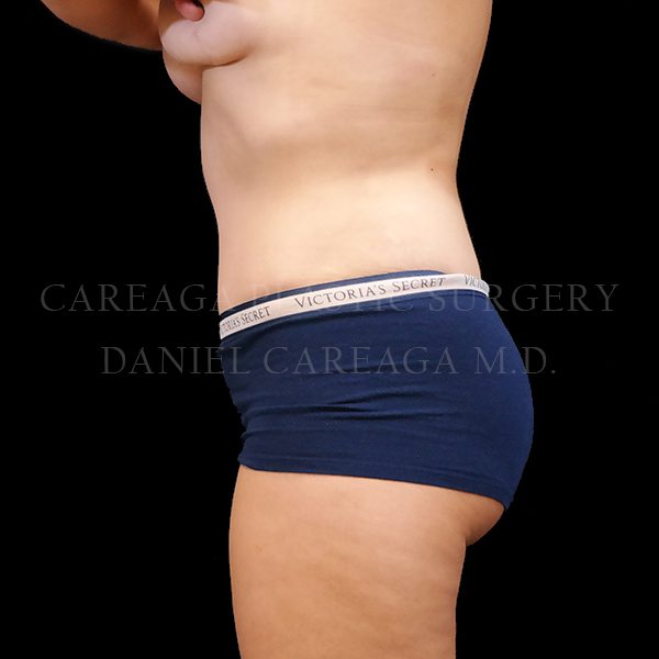 After Image