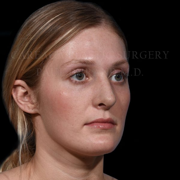 After Image