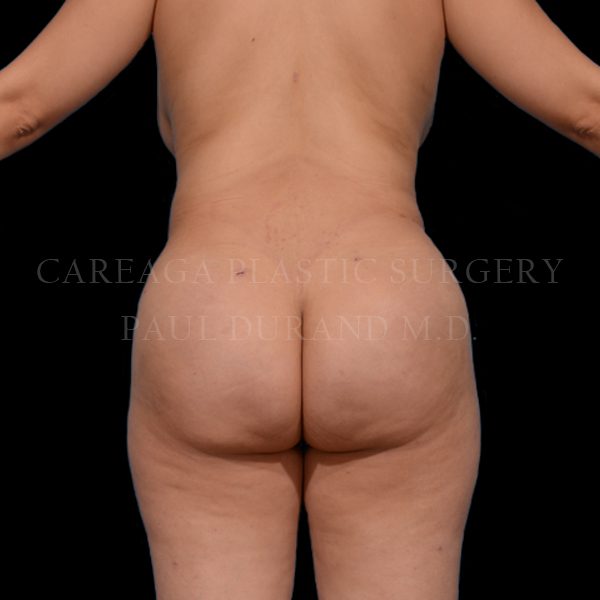 After Image