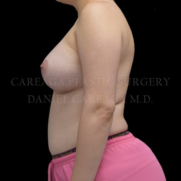 After Image