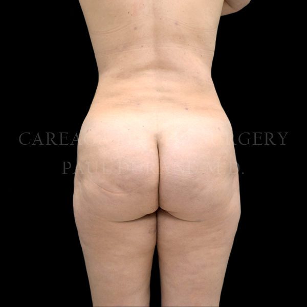 After Image