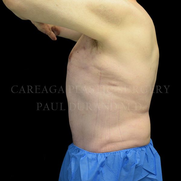 After Image