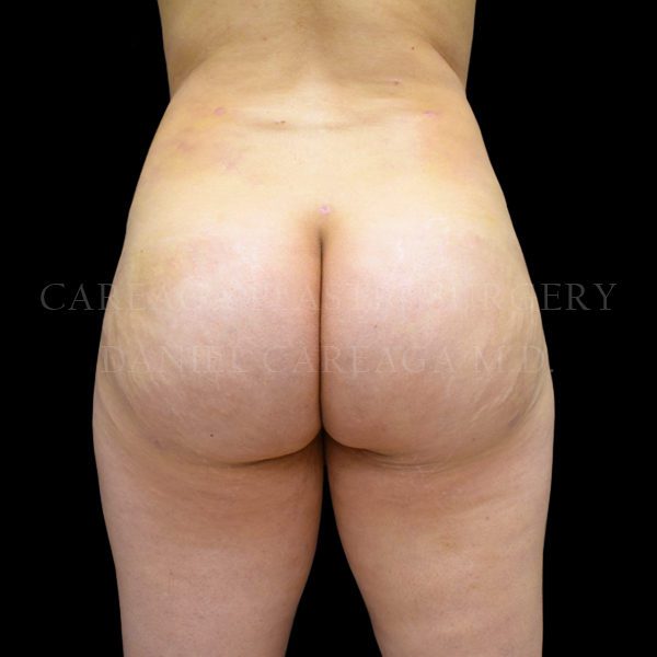 After Image