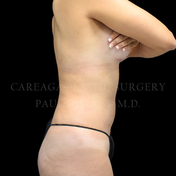 After Image