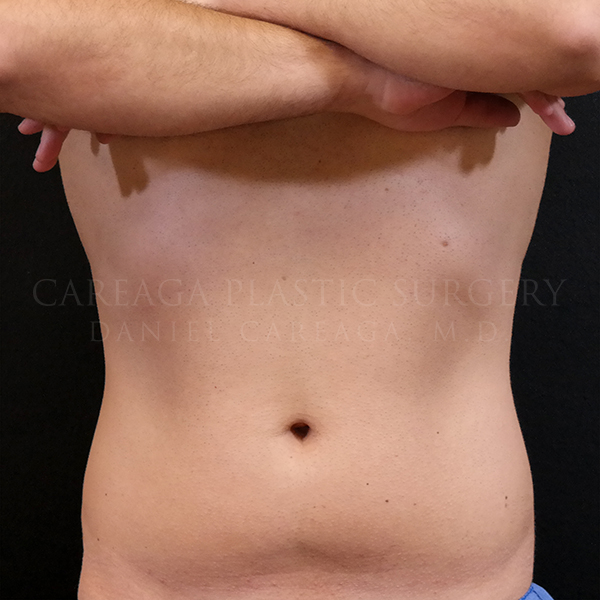 Before Image
