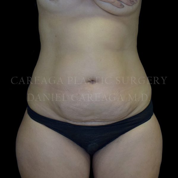 Before Image