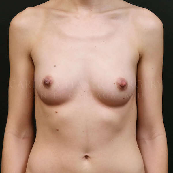 Before Image